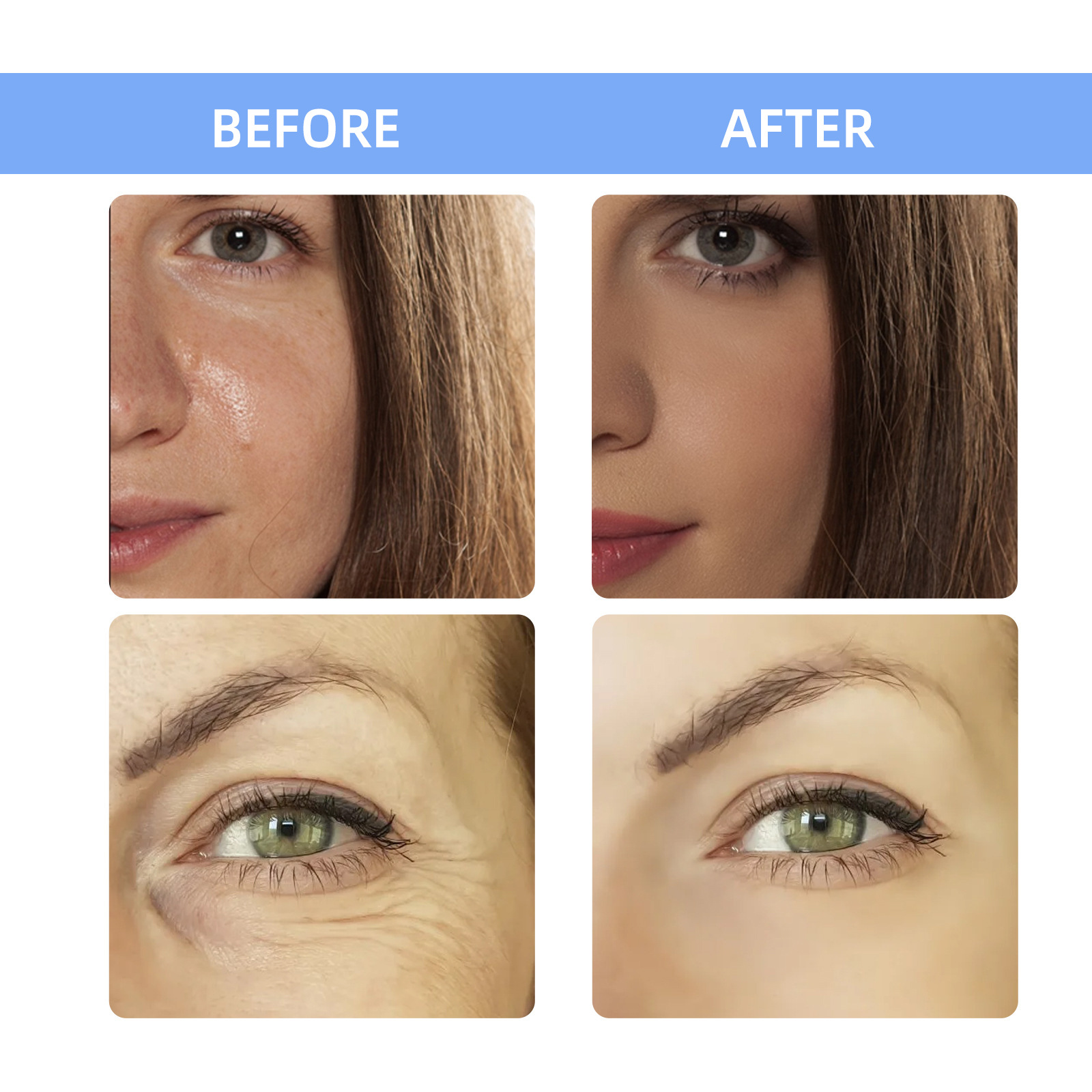 2ml*7pcs Hyaluronic acid Meso  - Hyaluronic Acid Facial Serum ulasan dan harga
