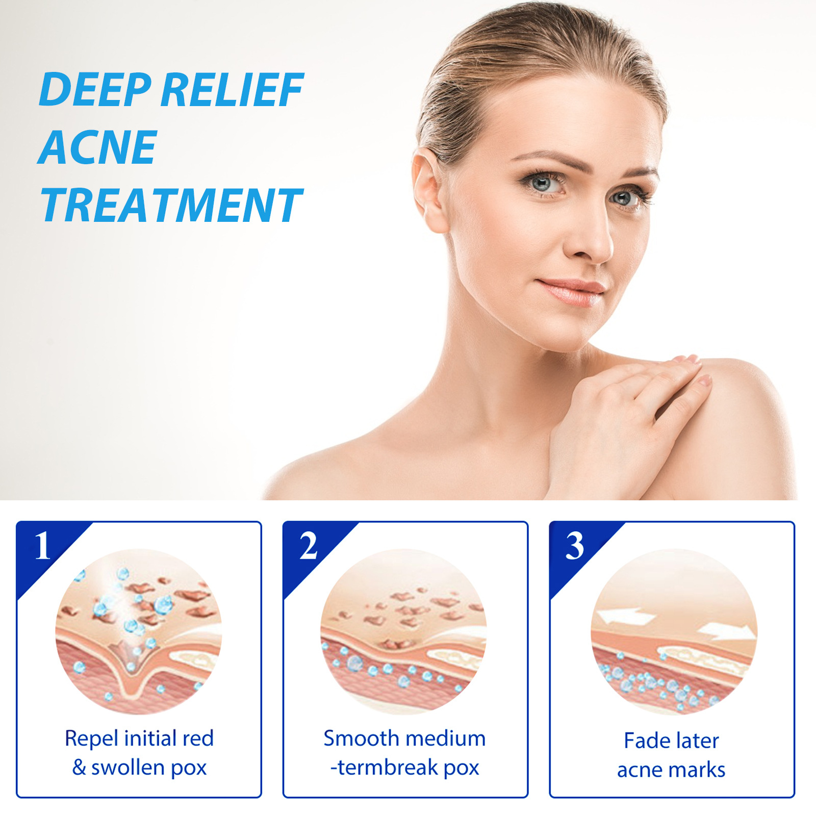EELHOE Acne Treatment Lotion S - Salicylic Acid Blackhead Remover ulasan dan harga